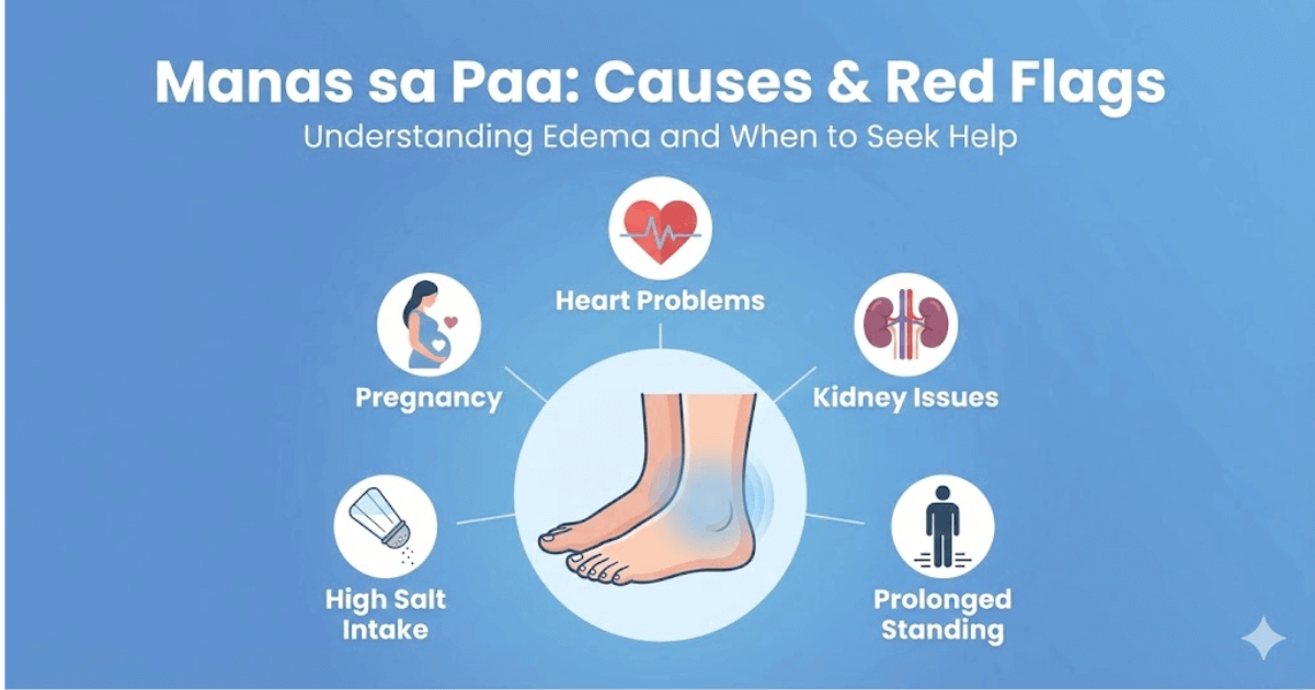 Manas sa Paa: Bakit Namamaga ang Paa Mo? (Causes, Red Flags, at Kailan Dapat Mag-Doctor)